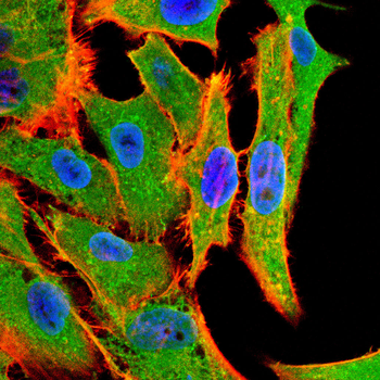 ACTB Antibody