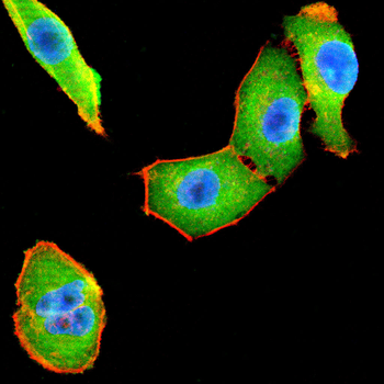 PPARD Antibody