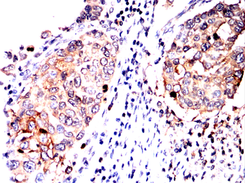 ALYREF Antibody