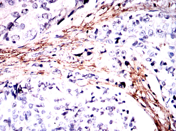 ELN Antibody