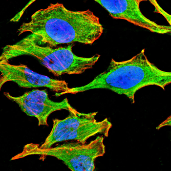 SLC6A3 Antibody