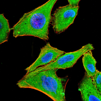 NR3C2 Antibody