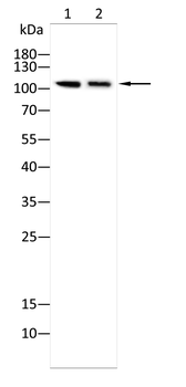 NR3C2 Antibody