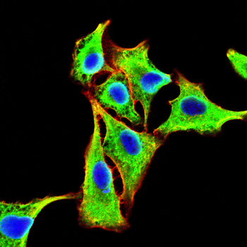 NR3C2 Antibody