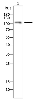 NR3C2 Antibody