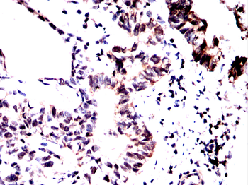 SEPTIN2 Antibody