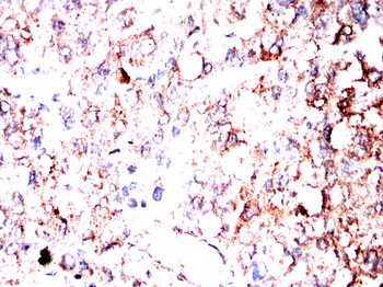 EFEMP1 Antibody