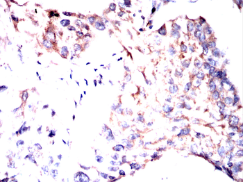 EFEMP1 Antibody