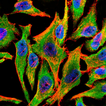 EFEMP1 Antibody