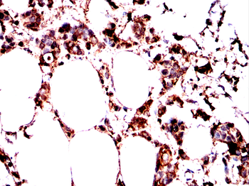 EFEMP1 Antibody
