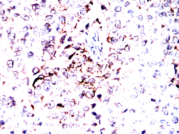 EFEMP1 Antibody