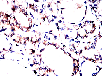PRMT7 Antibody