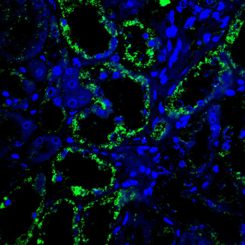 PRDX3 Antibody