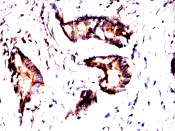 PRDX3 Antibody