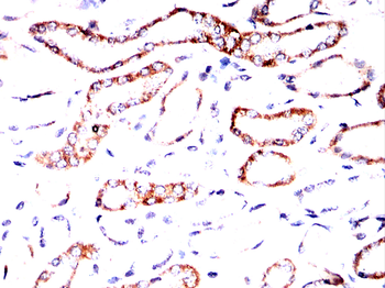 PRDX3 Antibody