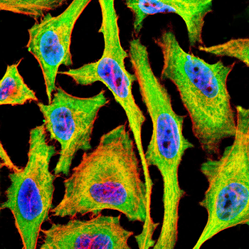 RAB13 Antibody