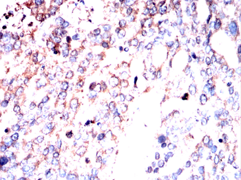 RAB13 Antibody