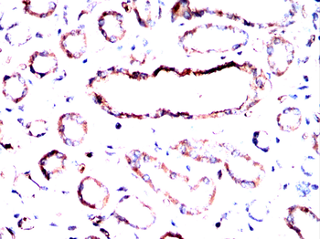 RAB13 Antibody