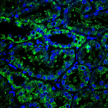RAB13 Antibody