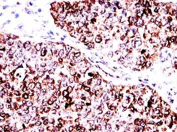 TFAM Antibody