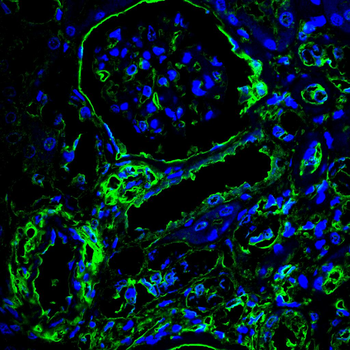 TFAM Antibody
