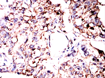 TFAM Antibody