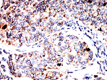 TMEM119 Antibody