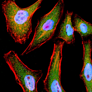 HDAC4 Antibody