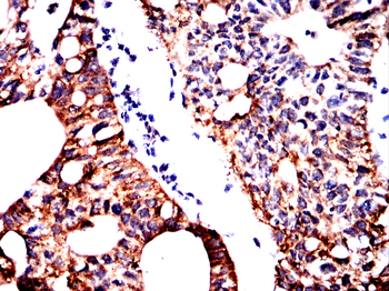 HDAC4 Antibody