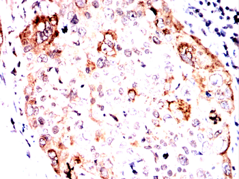 HDAC4 Antibody