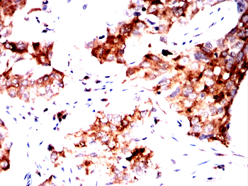 HDAC4 Antibody