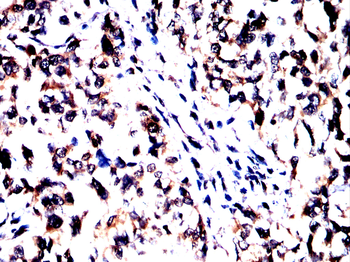 SLIT2 Antibody