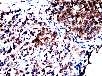 SLIT2 Antibody