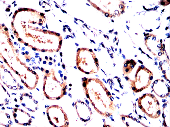 SLIT2 Antibody