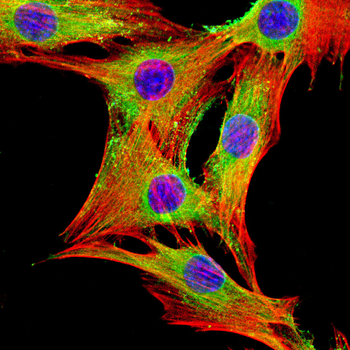 SLIT2 Antibody