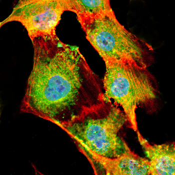 UCP1 Antibody