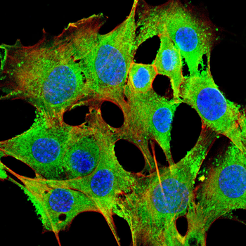 UCP1 Antibody