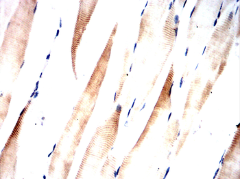CLPP Antibody