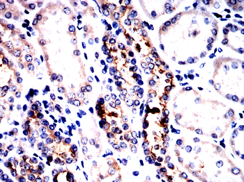 SLC12A1 Antibody