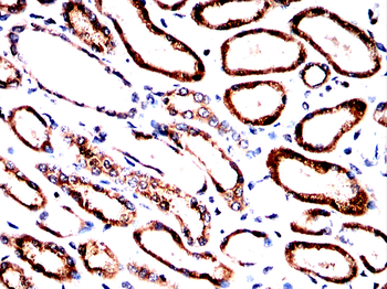 SLC12A1 Antibody