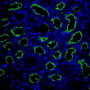 SLC12A1 Antibody