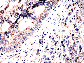 SLC12A1 Antibody