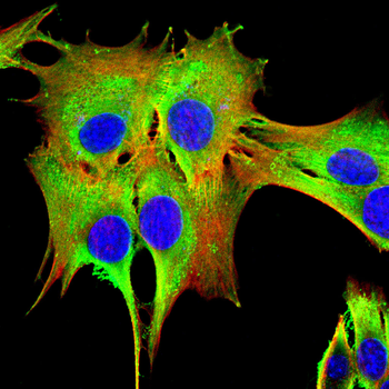 SLC12A1 Antibody