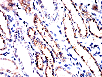 SLC12A1 Antibody
