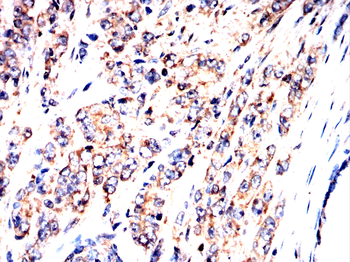 SLC12A1 Antibody