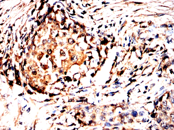 ADRB2 Antibody