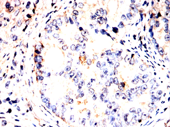 ADRB2 Antibody