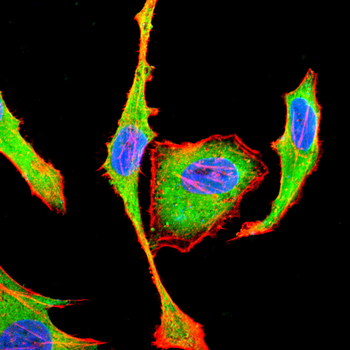 ADRB2 Antibody