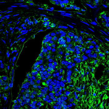 EP300 Antibody