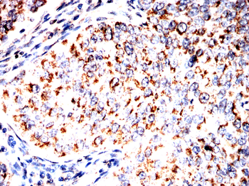 EP300 Antibody